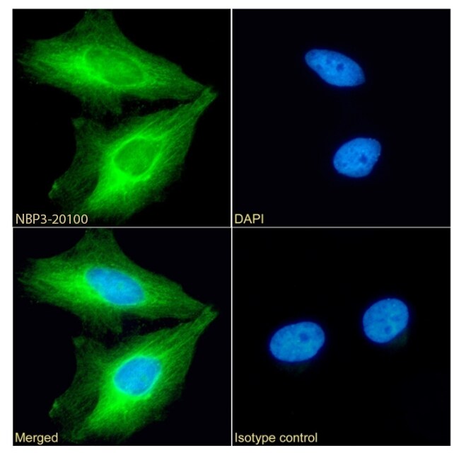 Fascin Antibody (SAIC-32C-205) - Azide and BSA Free