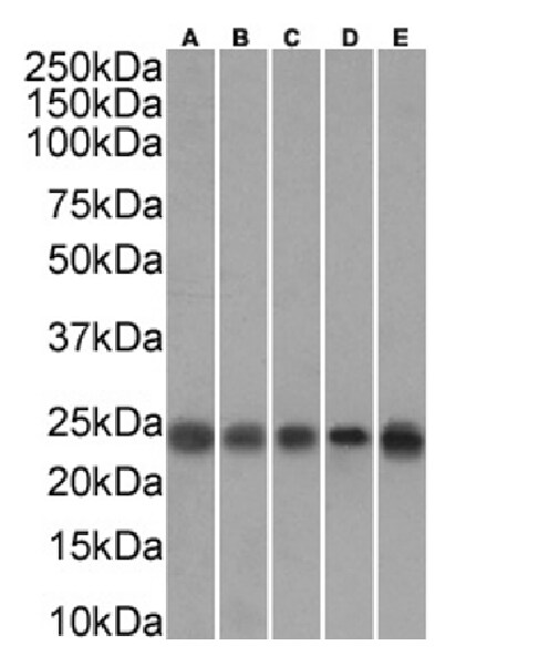 Transgelin/TAGLN/SM22 alpha Antibody (SAIC-33B-129) - Azide and BSA Free