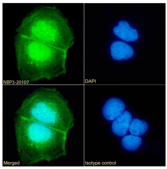 UbcH10/UBE2C Antibody (SAIC-41A-1) - Azide and BSA Free