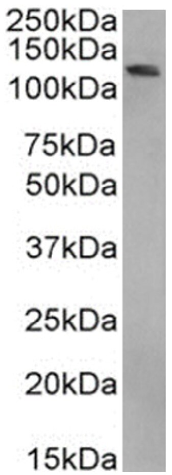 BRD4 Antibody (RAB-C131) - Chimeric - Azide and BSA Free