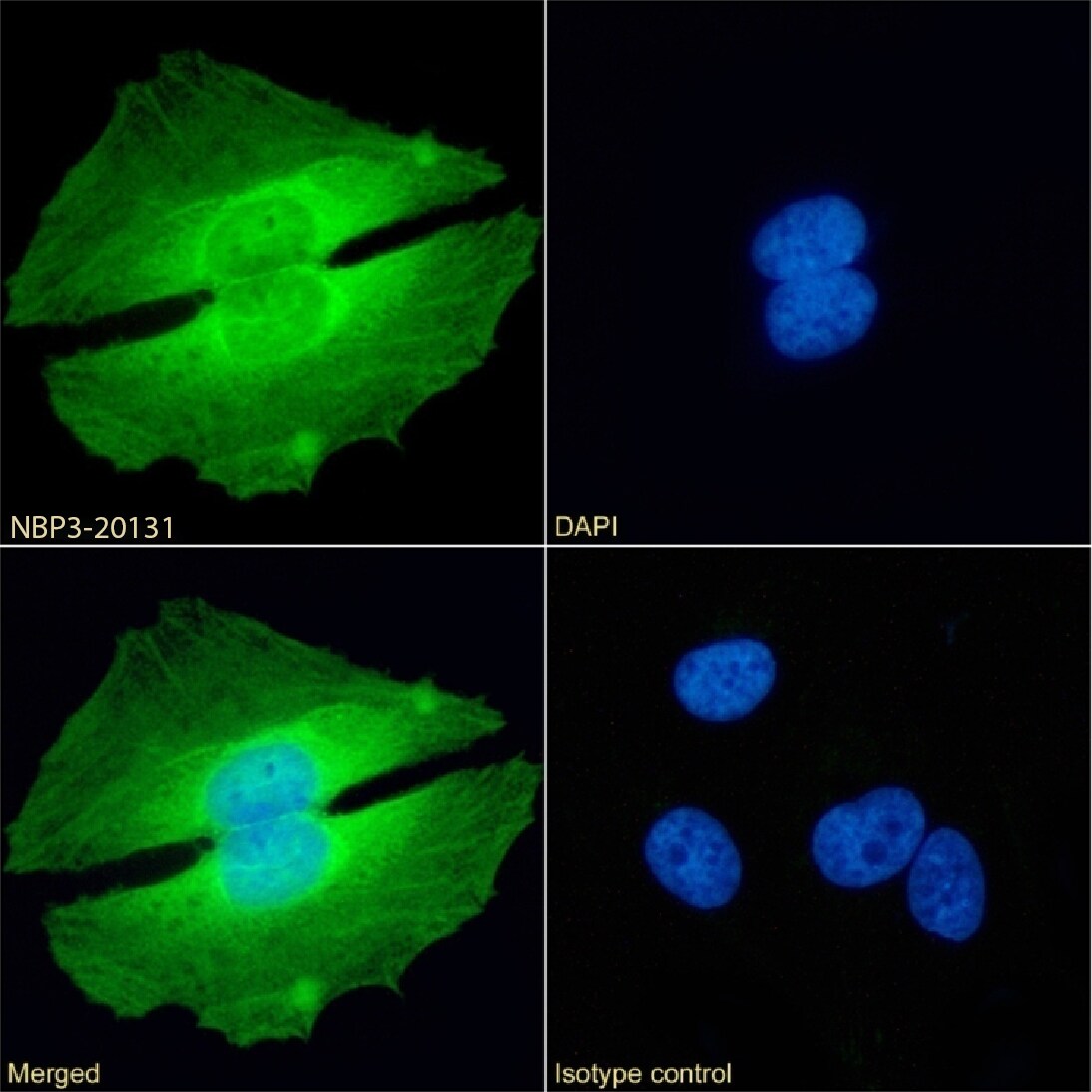 PRMT5 Antibody (RAB-C136) - Chimeric - Azide and BSA Free