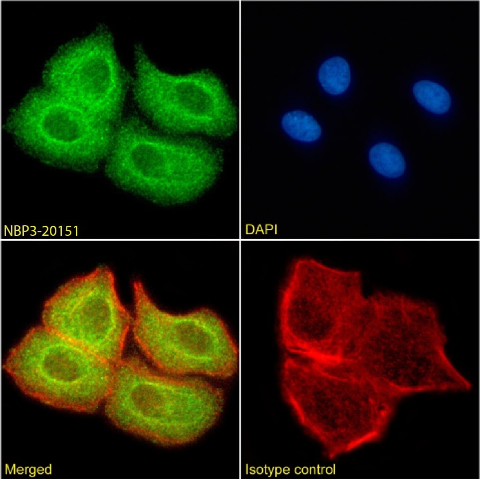 SUV420H2 Antibody (RAB-C409) - Chimeric - Azide and BSA Free