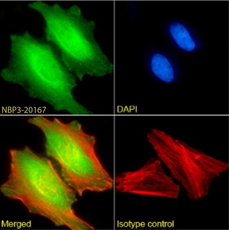 MAGEA3 Antibody (21B4) - Chimeric - Azide and BSA Free