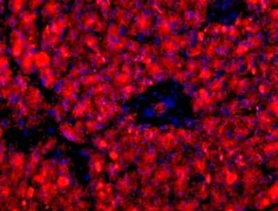 Pancreatic Cell Marker Antibody Pack