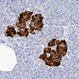 Pancreatic Cell Marker Antibody Pack