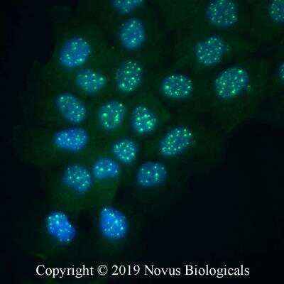 Parthanatos Antibody Pack