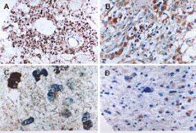 Executioner Caspases Antibody Pack