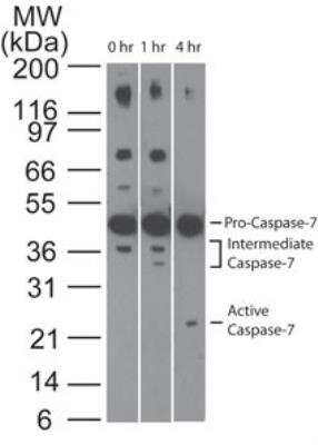 Executioner Caspases Antibody Pack