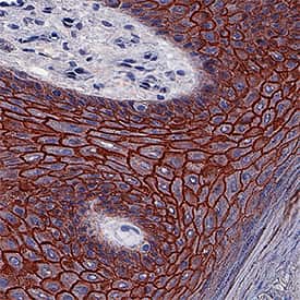 Desmoglein Family Antibody Pack