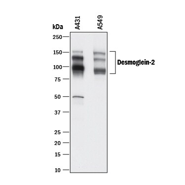 Desmoglein Family Antibody Pack