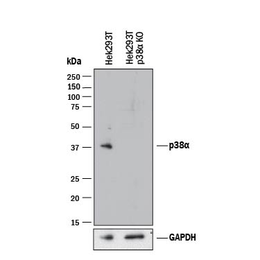 MAPK Family Antibody Pack