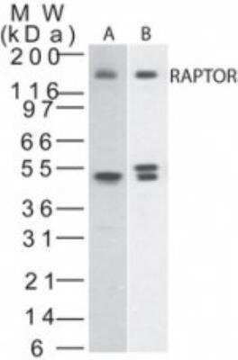 mTOR Pathway Antibody Pack