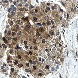 Cell Cycle Regulation Antibody Pack