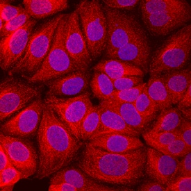 Mitochondrial Markers Antibody Pack