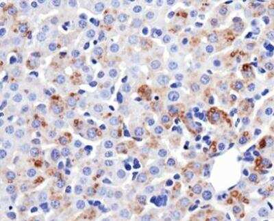 Mitochondrial Markers Antibody Pack