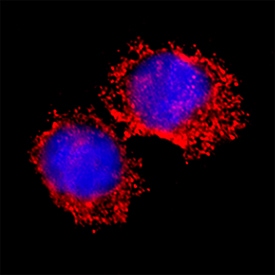 Src Family Kinases Antibody Pack
