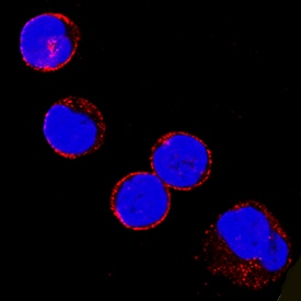 Src Family Kinases Antibody Pack