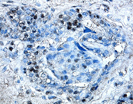Src Family Kinases Antibody Pack
