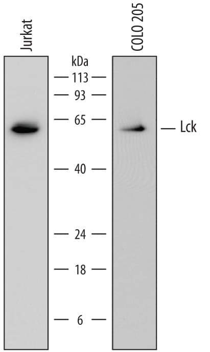 Src Family Kinases Antibody Pack