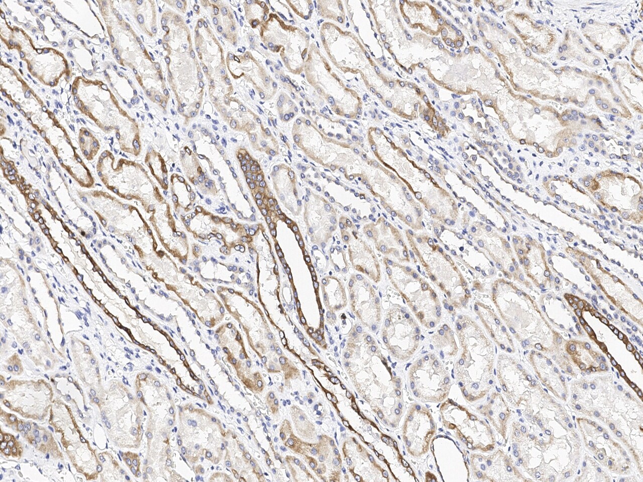 CH25H Antibody