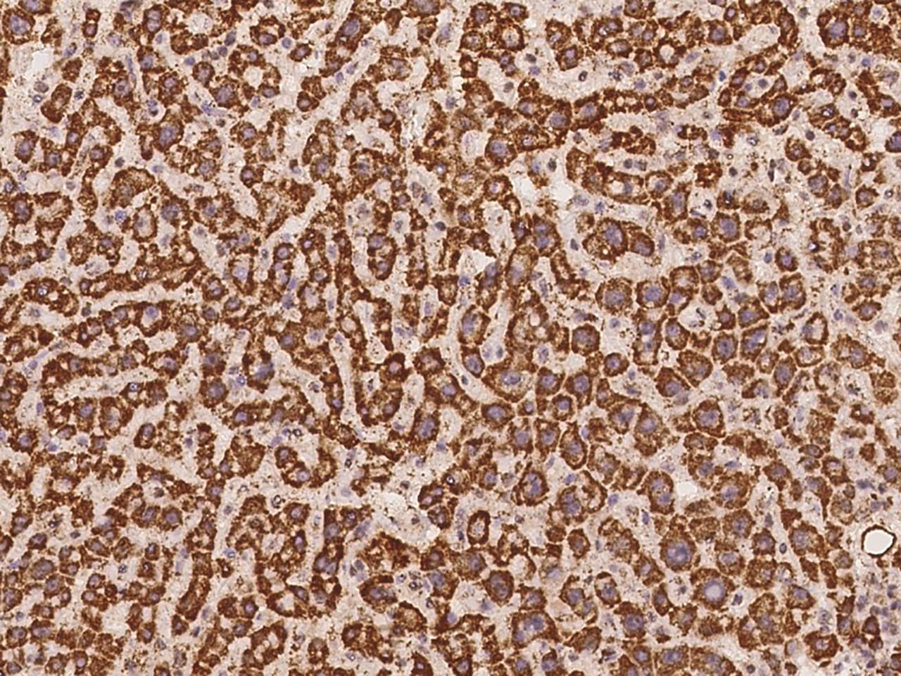 GNPNAT1 Antibody - BSA Free