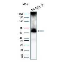 PRAME Antibody (PRAME/8558R) Western Blot: PRAME Antibody (PRAME/8558R) [NBP3-20238] -