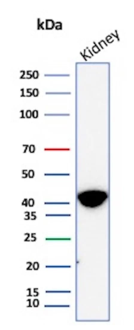 alpha-Methylacyl-CoA Racemase/AMACR Antibody (AMACR/8350R) Western Blot: alpha-Methylacyl-CoA Racemase/AMACR Antibody (AMACR/8350R) [NBP3-20239] -