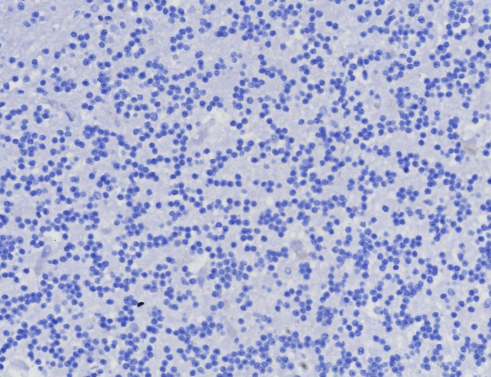 alpha-Methylacyl-CoA Racemase/AMACR Antibody (AMACR/8350R)