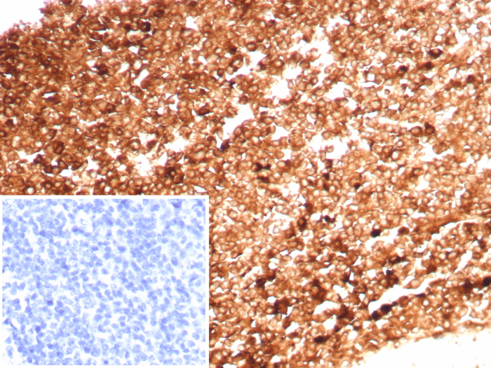 Ferritin Heavy Chain Antibody (FTH/8700R)