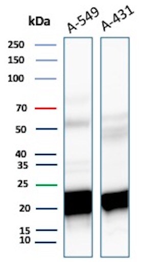 Ferritin Heavy Chain Antibody (FTH/8700R) Western Blot: Ferritin Heavy Chain Antibody (FTH/8700R) [NBP3-20251] -
