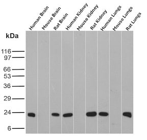 Ferritin Heavy Chain Antibody (FTH/8700R) Western Blot: Ferritin Heavy Chain Antibody (FTH/8700R) [NBP3-20251] -