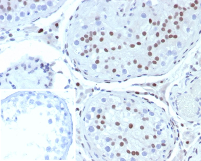 SF-1/NR5A1/Steroidogenic Factor 1 Antibody (SF1/8000R)