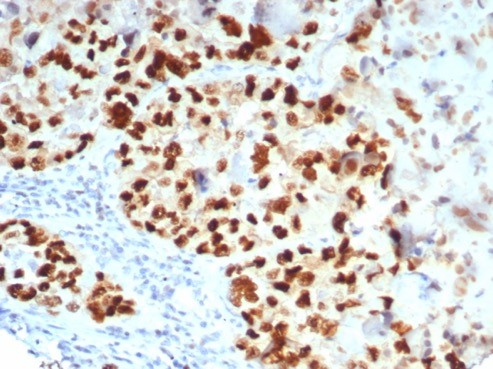GATA-3 Antibody (GATA3/7685R)
