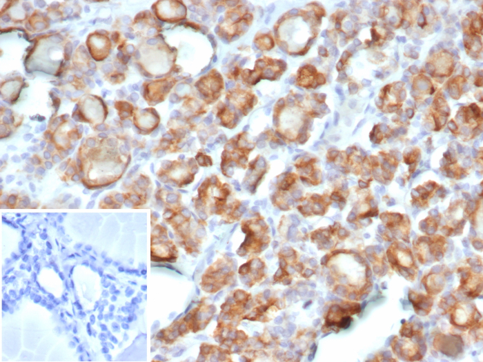 Thyroid Peroxidase Antibody (TPO/7088R)