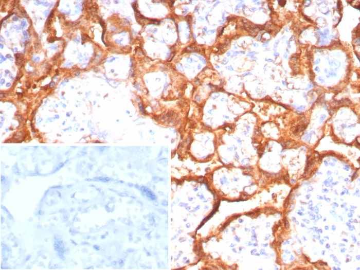 Growth Hormone Antibody (GH/8215R)