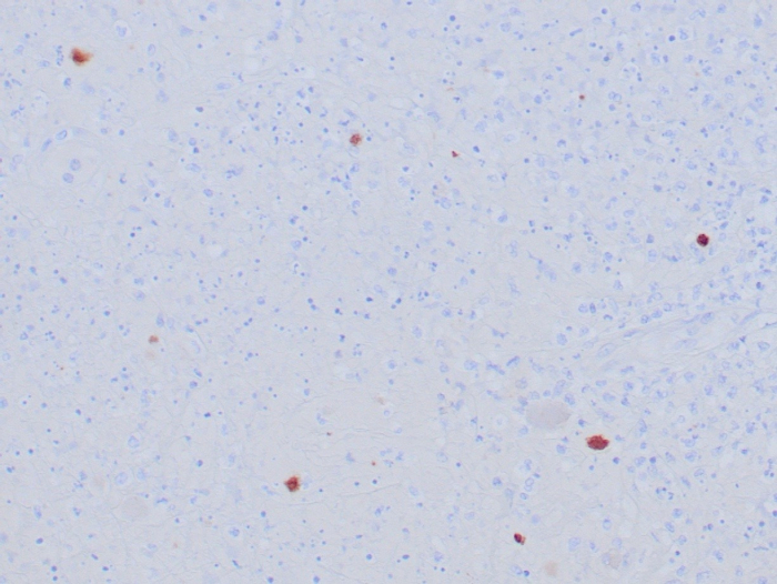 Herpes Simplex Virus 1 Antibody (HSVI/8375R)