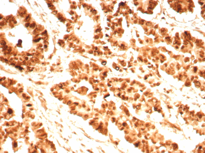 PCNA Antibody (PCNA/8696R)