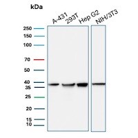 PCNA Antibody (PCNA/8696R) Western Blot: PCNA Antibody (PCNA/8696R) [NBP3-20277] -