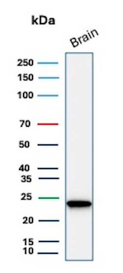 UCH-L1/PGP9.5 Antibody (rUCHL1/8133) Western Blot: UCH-L1/PGP9.5 Antibody (rUCHL1/8133) [NBP3-20279] -