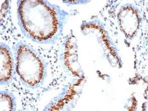 Golgi Glycoprotein 1/GLG1 Antibody (GLG1/4830)
