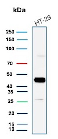 Cytokeratin 20 Antibody (KRT20/7805R) Western Blot: Cytokeratin 20 Antibody (KRT20/7805R) [NBP3-20298] -