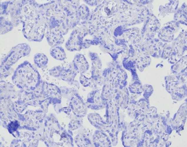 BOB1 Antibody (BOB1/7468)