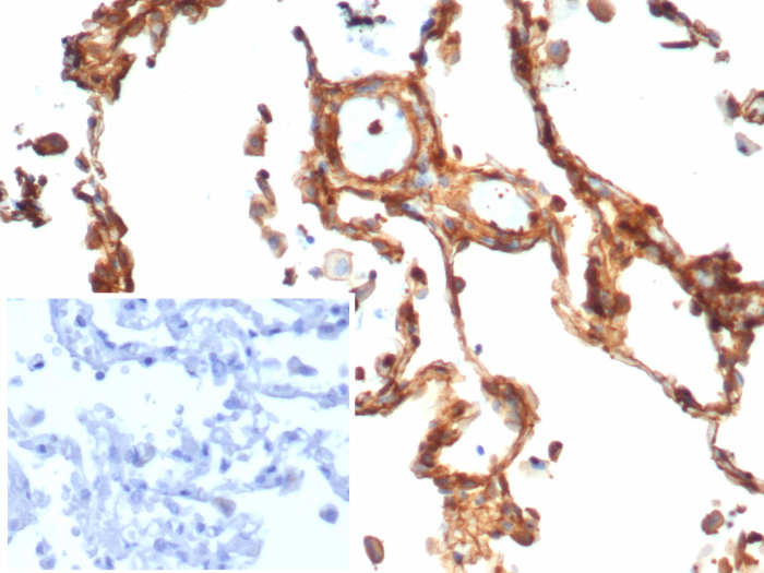 Vinculin Antibody (rVCL/7287)