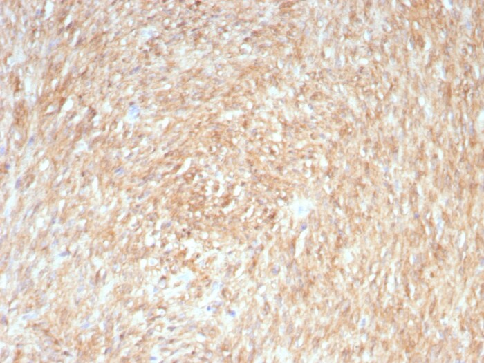 DOG1/TMEM16A Antibody (rDG1/447) DOG1/TMEM16A Antibody (rDG1/447) - Azide and BSA Free