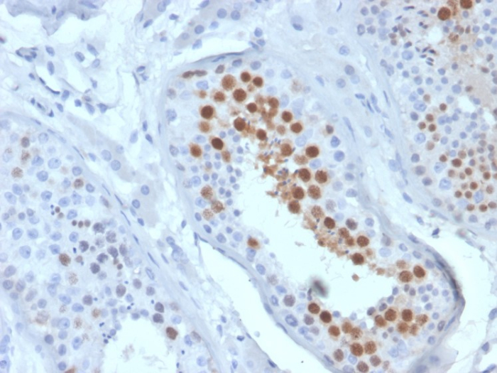 KIF2C Antibody (KIF2C/6519)