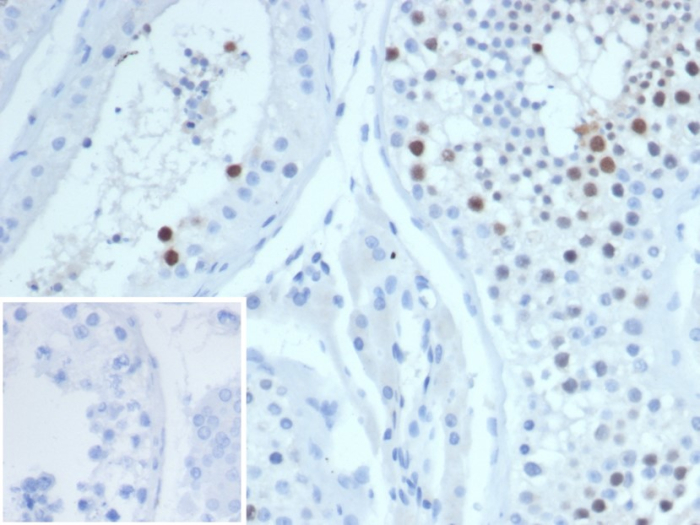 KIF2C Antibody (KIF2C/6519)