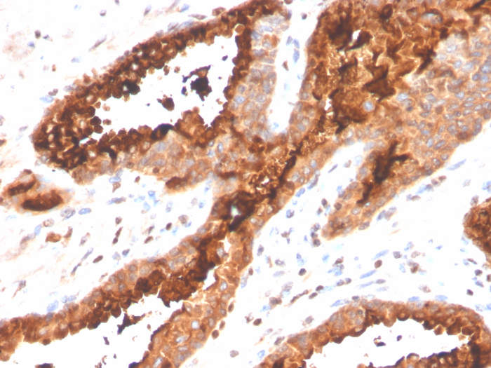 Prostatic Acid Phosphatase/ACPP Antibody (ACPP/4495R)