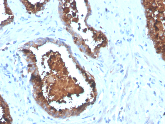 Prostatic Acid Phosphatase/ACPP Antibody (ACPP/4495R)