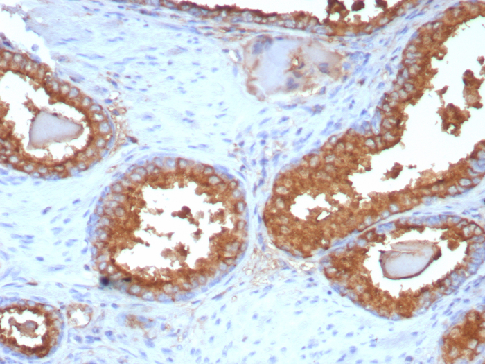 Prostatic Acid Phosphatase/ACPP Antibody (ACPP/8409R)