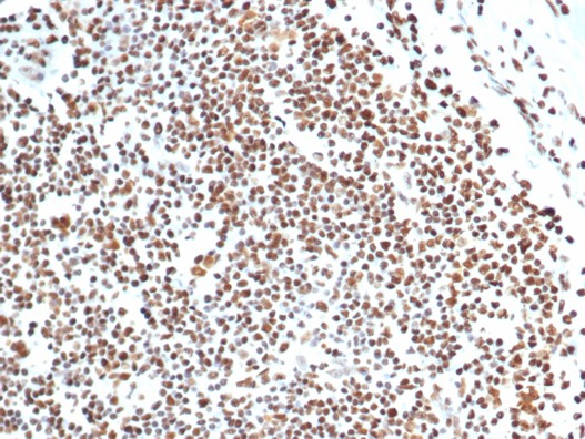 Ku80/XRCC5 Antibody (XRCC5/7316)